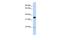 Phosphatidylinositol Transfer Protein Beta antibody, GTX45365, GeneTex, Western Blot image 