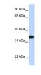 Hyaluronan Synthase 3 antibody, NBP1-62552, Novus Biologicals, Western Blot image 