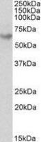 Glutamate Decarboxylase 2 antibody, GTX89575, GeneTex, Western Blot image 