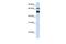 Atlastin GTPase 3 antibody, GTX46354, GeneTex, Western Blot image 