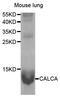 Calcitonin Related Polypeptide Alpha antibody, orb167412, Biorbyt, Western Blot image 