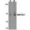 Major Facilitator Superfamily Domain Containing 1 antibody, MBS150275, MyBioSource, Western Blot image 