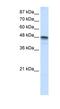 RNA Binding Motif Single Stranded Interacting Protein 3 antibody, NBP1-57147, Novus Biologicals, Western Blot image 