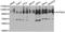 ATPase Sarcoplasmic/Endoplasmic Reticulum Ca2+ Transporting 2 antibody, MBS126649, MyBioSource, Western Blot image 