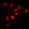 CCAAT Enhancer Binding Protein Beta antibody, GTX55008, GeneTex, Immunofluorescence image 