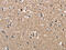 Phosphoglycerate Kinase 1 antibody, CSB-PA547426, Cusabio, Immunohistochemistry paraffin image 