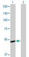 Immunoglobulin Heavy Constant Gamma 1 (G1m Marker) antibody, H00003500-D01P, Novus Biologicals, Western Blot image 