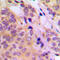 Mitogen-Activated Protein Kinase Kinase Kinase 8 antibody, LS-C353944, Lifespan Biosciences, Immunohistochemistry paraffin image 