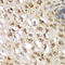 Serum/Glucocorticoid Regulated Kinase 1 antibody, LS-C331214, Lifespan Biosciences, Immunohistochemistry paraffin image 