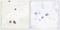 ATPase H+ Transporting Accessory Protein 2 antibody, LS-C118716, Lifespan Biosciences, Immunohistochemistry paraffin image 