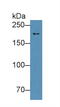 Nucleoporin 210 antibody, LS-C295700, Lifespan Biosciences, Western Blot image 