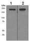 SWI/SNF Related, Matrix Associated, Actin Dependent Regulator Of Chromatin, Subfamily A, Member 4 antibody, ab108318, Abcam, Western Blot image 