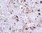 Transmembrane Protein 18 antibody, NBP2-81843, Novus Biologicals, Immunohistochemistry frozen image 