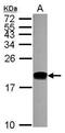 DNA Polymerase Epsilon 3, Accessory Subunit antibody, PA5-30743, Invitrogen Antibodies, Western Blot image 