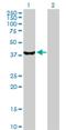 Serine/Threonine Kinase 19 antibody, H00008859-D01P, Novus Biologicals, Western Blot image 