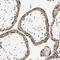 Msh Homeobox 2 antibody, NBP1-85445, Novus Biologicals, Immunohistochemistry paraffin image 