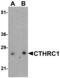 Collagen Triple Helix Repeat Containing 1 antibody, MBS153579, MyBioSource, Western Blot image 