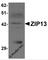 Solute Carrier Family 39 Member 13 antibody, 6103, ProSci, Western Blot image 