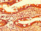 Interleukin 17F antibody, LS-C674273, Lifespan Biosciences, Immunohistochemistry paraffin image 