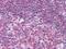 Protein Tyrosine Kinase 2 Beta antibody, GTX83026, GeneTex, Immunohistochemistry paraffin image 
