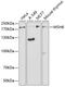 MutS Homolog 6 antibody, 18-979, ProSci, Western Blot image 