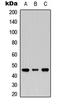 Mannan Binding Lectin Serine Peptidase 1 antibody, LS-C354421, Lifespan Biosciences, Western Blot image 