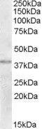 NME/NM23 Family Member 9 antibody, GTX88768, GeneTex, Western Blot image 