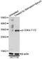 Cyclin Dependent Kinase 4 antibody, STJ29359, St John