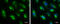 Hydroxyacyl-CoA Dehydrogenase Trifunctional Multienzyme Complex Subunit Alpha antibody, GTX101177, GeneTex, Immunofluorescence image 