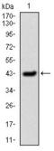 Serpin Family E Member 1 antibody, GTX60537, GeneTex, Western Blot image 