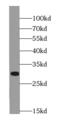 Inhibitor Of Growth Family Member 1 antibody, FNab04309, FineTest, Western Blot image 