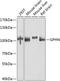 Gephyrin antibody, A04560, Boster Biological Technology, Western Blot image 