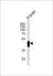 Cyclin-dependent kinase 14 antibody, LS-B13748, Lifespan Biosciences, Western Blot image 