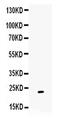 Gremlin 1, DAN Family BMP Antagonist antibody, PA5-79324, Invitrogen Antibodies, Western Blot image 