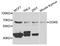 Hydroxysteroid 17-Beta Dehydrogenase 3 antibody, A04128, Boster Biological Technology, Western Blot image 