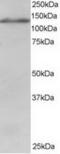 Ubiquitin Specific Peptidase 11 antibody, TA302871, Origene, Western Blot image 