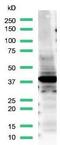 Transcription Termination Factor 1 antibody, PA5-32633, Invitrogen Antibodies, Western Blot image 