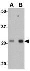 Three Prime Repair Exonuclease 1 antibody, GTX31367, GeneTex, Western Blot image 