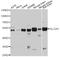 Solute Carrier Family 2 Member 1 antibody, STJ29062, St John