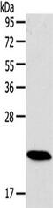 RAB18, Member RAS Oncogene Family antibody, TA321889, Origene, Western Blot image 