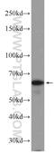 Protein Phosphatase 2 Regulatory Subunit B''Beta antibody, 24502-1-AP, Proteintech Group, Western Blot image 