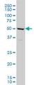 T-Box 6 antibody, H00006911-M06, Novus Biologicals, Western Blot image 