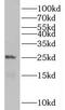 PEST Proteolytic Signal Containing Nuclear Protein antibody, FNab06218, FineTest, Western Blot image 