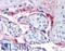 Integrin Subunit Beta 3 antibody, LS-B4046, Lifespan Biosciences, Immunohistochemistry paraffin image 