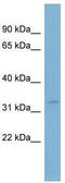 Solute Carrier Family 25 Member 20 antibody, TA334168, Origene, Western Blot image 