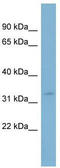 Mitochondrial carnitine/acylcarnitine carrier protein antibody, TA334168, Origene, Western Blot image 