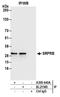 SRP Receptor Subunit Beta antibody, A305-440A, Bethyl Labs, Immunoprecipitation image 