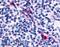 C-X-C Motif Chemokine Receptor 6 antibody, LS-A1104, Lifespan Biosciences, Immunohistochemistry paraffin image 