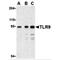 Toll Like Receptor 9 antibody, MBS150784, MyBioSource, Western Blot image 
