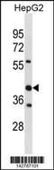 Stomatin Like 2 antibody, 60-963, ProSci, Western Blot image 